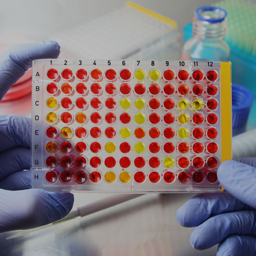 MICROBIOLOGY - Nitsos Lab