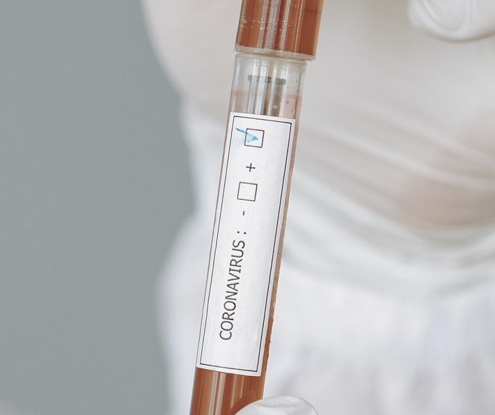 Molecular testing of coronavirus (SARS-CoV-2) - Nitsoslab