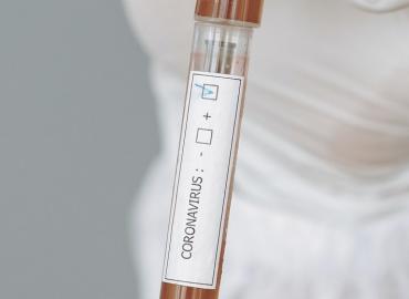 Molecular testing of coronavirus (SARS-CoV-2) - Nitsoslab