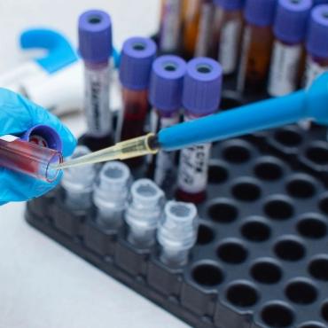 Ορμονολογικό