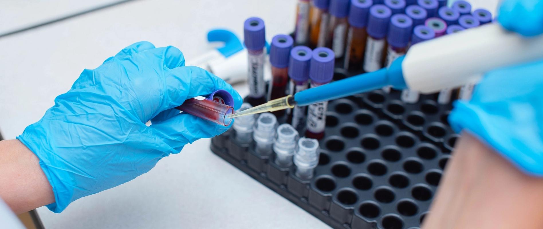 Ορμονολογικό